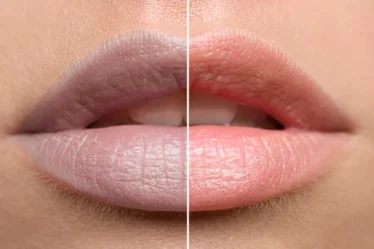 The best use of castor oil for lips